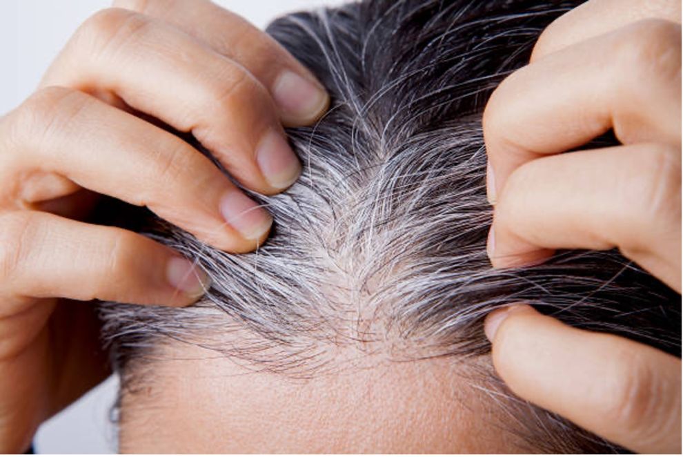 No es ciencia ficción, las canas pueden revertirse (y no hablamos de fármacos ni tintes)